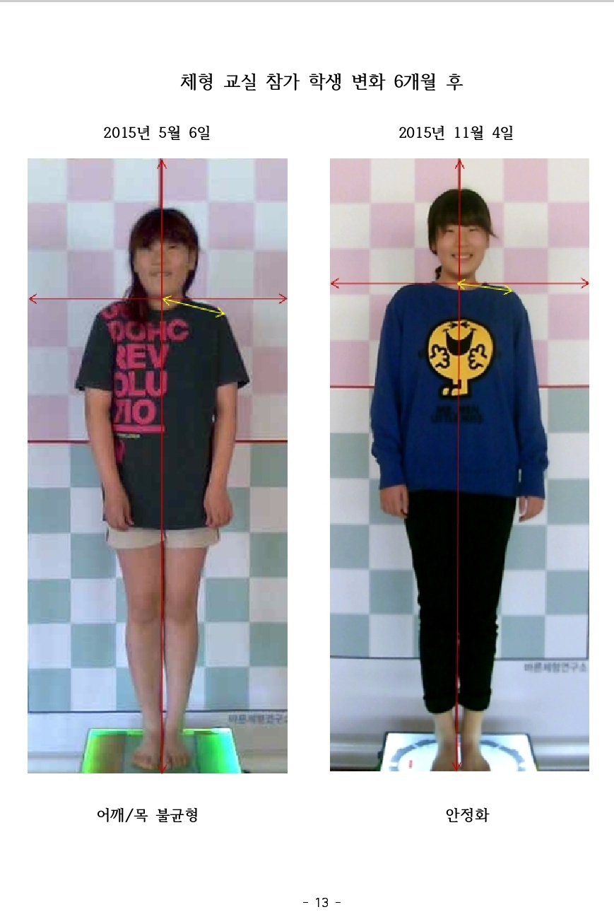 자세 안정화 성공 사례