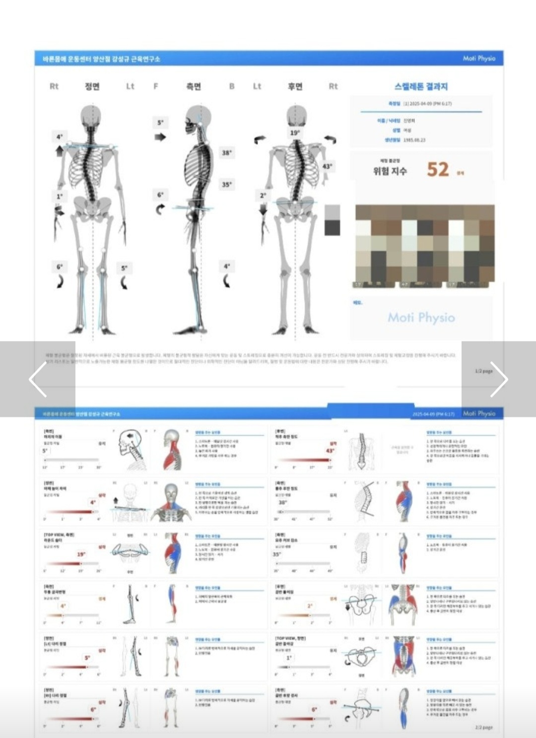 체형 분석 결과 리포트
